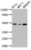 Western Blot<br />
 Positive WB detected in: Hela whole cell lysate, MCF-7 whole cell lysate, HEK293 whole cell lysate<br />
 All lanes: PACSIN3 antibody at 2.8µg/ml<br />
 Secondary<br />
 Goat polyclonal to rabbit IgG at 1/50000 dilution<br />
 Predicted band size: 49 kDa<br />
 Observed band size: 49 kDa<br />