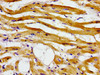 Immunohistochemistry of paraffin-embedded human heart tissue using CSB-PA001342LA01HU at dilution of 1:100