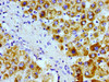Immunohistochemistry of paraffin-embedded human liver tissue using CSB-PA001468LA01HU at dilution of 1:100