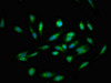 Immunofluorescent analysis of Hela cells using CSB-PA002339LA01HU at dilution of 1:100 and Alexa Fluor 488-congugated AffiniPure Goat Anti-Rabbit IgG (H+L)