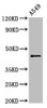 Western Blot<br />
 Positive WB detected in: A549 whole cell lysate<br />
 All lanes: CCNB2 antibody at 2.5µg/ml<br />
 Secondary<br />
 Goat polyclonal to rabbit IgG at 1/50000 dilution<br />
 Predicted band size: 46 kDa<br />
 Observed band size: 46 kDa<br />