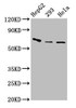 Western Blot<br />
 Positive WB detected in: HepG2 whole cell lysate, 293 whole cell lysate, Hela whole cell lysate<br />
 All lanes: CFI antibody at 3.2µg/ml<br />
 Secondary<br />
 Goat polyclonal to rabbit IgG at 1/50000 dilution<br />
 Predicted band size: 66 kDa<br />
 Observed band size: 66 kDa<br />