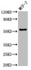 Western Blot<br />
 Positive WB detected in: MCF-7 whole cell lysate<br />
 All lanes: CHKA antibody at 3µg/ml<br />
 Secondary<br />
 Goat polyclonal to rabbit IgG at 1/50000 dilution<br />
 Predicted band size: 53, 51 kDa<br />
 Observed band size: 53 kDa<br />