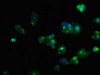 Immunofluorescent analysis of HepG2 cells using CSB-PA006255LA01HU at dilution of 1:100 and Alexa Fluor 488-congugated AffiniPure Goat Anti-Rabbit IgG (H+L)