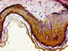 Immunohistochemistry of paraffin-embedded human skin tissue using CSB-PA009264LA01HU at dilution of 1:100