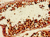 Immunohistochemistry of paraffin-embedded human testis tissue using CSB-PA010520LA01HU at dilution of 1:100
