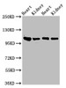 Western Blot<br />
 Positive WB detected in: Rat heart tissue, Rat kidney tissue, Mouse heart tisseu, Mouse kidney tissue<br />
 All lanes: ITGA6 antibody at 3µg/ml<br />
 Secondary<br />
 Goat polyclonal to rabbit IgG at 1/50000 dilution<br />
 Predicted band size: 127, 120, 123, 122, 125, 107 kDa<br />
 Observed band size: 100 kDa<br />