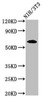 Western Blot<br />
 Positive WB detected in: NIH/3T3 whole cell lysate<br />
 All lanes: IVL antibody at 3.2µg/ml<br />
 Secondary<br />
 Goat polyclonal to rabbit IgG at 1/50000 dilution<br />
 Predicted band size: 69 kDa<br />
 Observed band size: 69 kDa<br />