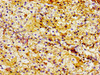 Immunohistochemistry of paraffin-embedded human adrenal gland tissue using CSB-PA013219LA01HU at dilution of 1:100