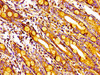 Immunohistochemistry of paraffin-embedded human small intestine tissue using CSB-PA014758LA01HU at dilution of 1:100