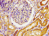 Immunohistochemistry of paraffin-embedded human kidney tissue using CSB-PA014758LA01HU at dilution of 1:100