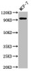 Western Blot<br />
 Positive WB detected in: MCF-7 whole cell lysate<br />
 All lanes: NCAM2 antibody at 2.7µg/ml<br />
 Secondary<br />
 Goat polyclonal to rabbit IgG at 1/50000 dilution<br />
 Predicted band size: 94, 48 kDa<br />
 Observed band size: 94 kDa<br />