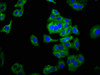 Immunofluorescence staining of HepG2 cells with CSB-PA015512LA01HU at 1:266, counter-stained with DAPI. The cells were fixed in 4% formaldehyde, permeabilized using 0.2% Triton X-100 and blocked in 10% normal Goat Serum. The cells were then incubated with the antibody overnight at 4°C. The secondary antibody was Alexa Fluor 488-congugated AffiniPure Goat Anti-Rabbit IgG (H+L) .