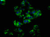 Immunofluorescence staining of HepG2 cells with CSB-PA015959LA01HU at 1:33, counter-stained with DAPI. The cells were fixed in 4% formaldehyde, permeabilized using 0.2% Triton X-100 and blocked in 10% normal Goat Serum. The cells were then incubated with the antibody overnight at 4°C. The secondary antibody was Alexa Fluor 488-congugated AffiniPure Goat Anti-Rabbit IgG (H+L) .