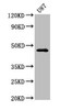 Western Blot<br />
 Positive WB detected in: U87 whole cell lysate<br />
 All lanes: NTSR2 antibody at 3.2µg/ml<br />
 Secondary<br />
 Goat polyclonal to rabbit IgG at 1/50000 dilution<br />
 Predicted band size: 46 kDa<br />
 Observed band size: 46 kDa<br />
