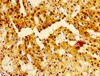 Immunohistochemistry of paraffin-embedded human adrenal gland tissue using CSB-PA016138LA01HU at dilution of 1:100
