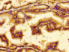 Immunohistochemistry of paraffin-embedded human prostate tissue using CSB-PA016138LA01HU at dilution of 1:100