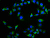 Immunofluorescence staining of Hela cells with CSB-PA016138LA01HU at 1:133, counter-stained with DAPI. The cells were fixed in 4% formaldehyde, permeabilized using 0.2% Triton X-100 and blocked in 10% normal Goat Serum. The cells were then incubated with the antibody overnight at 4°C. The secondary antibody was Alexa Fluor 488-congugated AffiniPure Goat Anti-Rabbit IgG (H+L) .