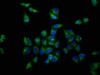 Immunofluorescence staining of Hela cells with CSB-PA016360LA01HU at 1:200, counter-stained with DAPI. The cells were fixed in 4% formaldehyde, permeabilized using 0.2% Triton X-100 and blocked in 10% normal Goat Serum. The cells were then incubated with the antibody overnight at 4°C. The secondary antibody was Alexa Fluor 488-congugated AffiniPure Goat Anti-Rabbit IgG (H+L) .