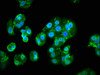Immunofluorescence staining of HepG2 cells with CSB-PA017998LA01HU at 1:133, counter-stained with DAPI. The cells were fixed in 4% formaldehyde, permeabilized using 0.2% Triton X-100 and blocked in 10% normal Goat Serum. The cells were then incubated with the antibody overnight at 4°C. The secondary antibody was Alexa Fluor 488-congugated AffiniPure Goat Anti-Rabbit IgG (H+L) .