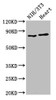 Western Blot<br />
 Positive WB detected in: NIH/3T3 whole cell lysate, Rat heart tissue<br />
 All lanes: RPS6KA3 antibody at 2µg/ml<br />
 Secondary<br />
 Goat polyclonal to rabbit IgG at 1/50000 dilution<br />
 Predicted band size: 84 kDa<br />
 Observed band size: 84 kDa<br />
