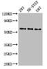 Western Blot<br />
 Positive WB detected in: 293 whole cell lysate, SH-SY5Y whole cell lysate, U87 whole cell lysate<br />
 All lanes: SLC11A2 antibody at 3µg/ml<br />
 Secondary<br />
 Goat polyclonal to rabbit IgG at 1/50000 dilution<br />
 Predicted band size: 63, 62, 65, 66 kDa<br />
 Observed band size: 63 kDa<br />
