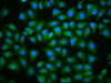 Immunofluorescence staining of Hela cells with CSB-PA025444LA01HU at 1:100, counter-stained with DAPI. The cells were fixed in 4% formaldehyde, permeabilized using 0.2% Triton X-100 and blocked in 10% normal Goat Serum. The cells were then incubated with the antibody overnight at 4°C. The secondary antibody was Alexa Fluor 488-congugated AffiniPure Goat Anti-Rabbit IgG (H+L) .