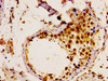 Immunohistochemistry of paraffin-embedded human testis tissue using CSB-PA025463LA01HU at dilution of 1:100