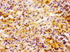 Immunohistochemistry of paraffin-embedded human adrenal gland tissue using CSB-PA025463LA01HU at dilution of 1:100