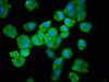 Immunofluorescence staining of HepG2 cells with CSB-PA025463LA01HU at 1:100, counter-stained with DAPI. The cells were fixed in 4% formaldehyde, permeabilized using 0.2% Triton X-100 and blocked in 10% normal Goat Serum. The cells were then incubated with the antibody overnight at 4°C. The secondary antibody was Alexa Fluor 488-congugated AffiniPure Goat Anti-Rabbit IgG (H+L) .