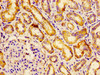 Immunohistochemistry of paraffin-embedded human kidney tissue using CSB-PA341920LA01HU at dilution of 1:100
