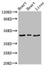 Western Blot<br />
 Positive WB detected in: Rat heart tissue, Mouse heart tissue, Mouse liver tissue<br />
 All lanes: ECI2 antibody at 2.7µg/ml<br />
 Secondary<br />
 Goat polyclonal to rabbit IgG at 1/50000 dilution<br />
 Predicted band size: 44, 40 kDa<br />
 Observed band size: 44 kDa<br />