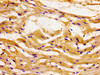 Immunohistochemistry of paraffin-embedded human heart tissue using CSB-PA614984LA01HU at dilution of 1:100