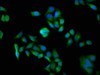 Immunofluorescence staining of Hela cells with CSB-PA618079LA01HU at 1:100, counter-stained with DAPI. The cells were fixed in 4% formaldehyde, permeabilized using 0.2% Triton X-100 and blocked in 10% normal Goat Serum. The cells were then incubated with the antibody overnight at 4°C. The secondary antibody was Alexa Fluor 488-congugated AffiniPure Goat Anti-Rabbit IgG (H+L) .