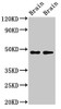 Western Blot<br />
 Positive WB detected in: Rat brain tissue, Mouse brain tissue<br />
 All lanes: CRHR2 antibody at 3µg/ml<br />
 Secondary<br />
 Goat polyclonal to rabbit IgG at 1/50000 dilution<br />
 Predicted band size: 48, 51, 47, 45, 43 kDa<br />
 Observed band size: 34 kDa<br />