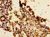 Immunohistochemistry of paraffin-embedded human lung tissue using CSB-PA623807LA01HU at dilution of 1:100