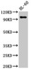 Western Blot<br />
 Positive WB detected in: HL60 whole cell lysate<br />
 All lanes: KMT5B antibody at 3µg/ml<br />
 Secondary<br />
 Goat polyclonal to rabbit IgG at 1/50000 dilution<br />
 Predicted band size: 100, 45, 32 kDa<br />
 Observed band size: 100 kDa<br />
