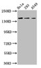 Western Blot<br />
 Positive WB detected in: Hela whole cell lysate, 293 whole cell lysate, A549 whole cell lysate<br />
 All lanes: CDON antibody at 3.4µg/ml<br />
 Secondary<br />
 Goat polyclonal to rabbit IgG at 1/50000 dilution<br />
 Predicted band size: 140, 137 kDa<br />
 Observed band size: 140 kDa<br />