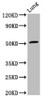 Western Blot<br />
 Positive WB detected in: Rat lung tissue<br />
 All lanes: ARHGAP1 antibody at 3.2µg/ml<br />
 Secondary<br />
 Goat polyclonal to rabbit IgG at 1/50000 dilution<br />
 Predicted band size: 51 kDa<br />
 Observed band size: 51 kDa<br />