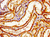 Immunohistochemistry of paraffin-embedded human kidney tissue using CSB-PA691829LA01HU at dilution of 1:100