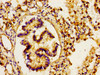 Immunohistochemistry of paraffin-embedded human lung tissue using CSB-PA691829LA01HU at dilution of 1:100