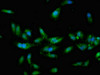 Immunofluorescent analysis of Hela cells using CSB-PA706631LA01HU at dilution of 1:100 and Alexa Fluor 488-congugated AffiniPure Goat Anti-Rabbit IgG (H+L)