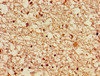 Immunohistochemistry of paraffin-embedded human brain tissue using CSB-PA722493LA01HU at dilution of 1:100