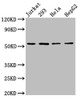 Western Blot<br />
 Positive WB detected in: Jurkat whole cell lysate, 293 whole cell lysate, Hela whole cell lysate, HepG2 whole cell lysate<br />
 All lanes: SLC16A12 antibody at 3µg/ml<br />
 Secondary<br />
 Goat polyclonal to rabbit IgG at 1/50000 dilution<br />
 Predicted band size: 54 kDa<br />
 Observed band size: 54 kDa<br /> Western Blot<br />
 Positive WB detected in: Jurkat whole cell lysate, 293 whole cell lysate, Hela whole cell lysate, HepG2 whole cell lysate<br />
 All lanes: SLC16A12 antibody at 3µg/ml<br />
 Secondary<br />
 Goat polyclonal to rabbit IgG at 1/50000 dilution<br />
 Predicted band size: 54 kDa<br />
 Observed band size: 54 kDa<br />
