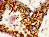 Immunohistochemistry of paraffin-embedded human testis tissue using CSB-PA757957LA01HU at dilution of 1:100