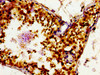 Immunohistochemistry of paraffin-embedded human testis tissue using CSB-PA757957LA01HU at dilution of 1:100 Immunohistochemistry of paraffin-embedded human testis tissue using CSB-PA757957LA01HU at dilution of 1:100