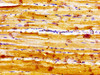Immunohistochemistry of paraffin-embedded human skeletal muscle tissue using CSB-PA757957LA01HU at dilution of 1:100 Immunohistochemistry of paraffin-embedded human skeletal muscle tissue using CSB-PA757957LA01HU at dilution of 1:100