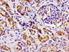 Immunohistochemistry of paraffin-embedded human kidney tissue using CSB-PA762568LA01HU at dilution of 1:100