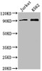 Western Blot<br />
 Positive WB detected in: Jurkat whole cell lysate, K562 whole cell lysate<br />
 All lanes: MARK2 antibody at 1:2000<br />
 Secondary<br />
 Goat polyclonal to rabbit IgG at 1/50000 dilution<br />
 Predicted band size: 88, 79, 84, 82, 81, 78, 87, 83, 80 kDa<br />
 Observed band size: 88 kDa<br />