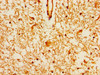Immunohistochemistry of paraffin-embedded human brain tissue using CSB-PA771436LA01HU at dilution of 1:100